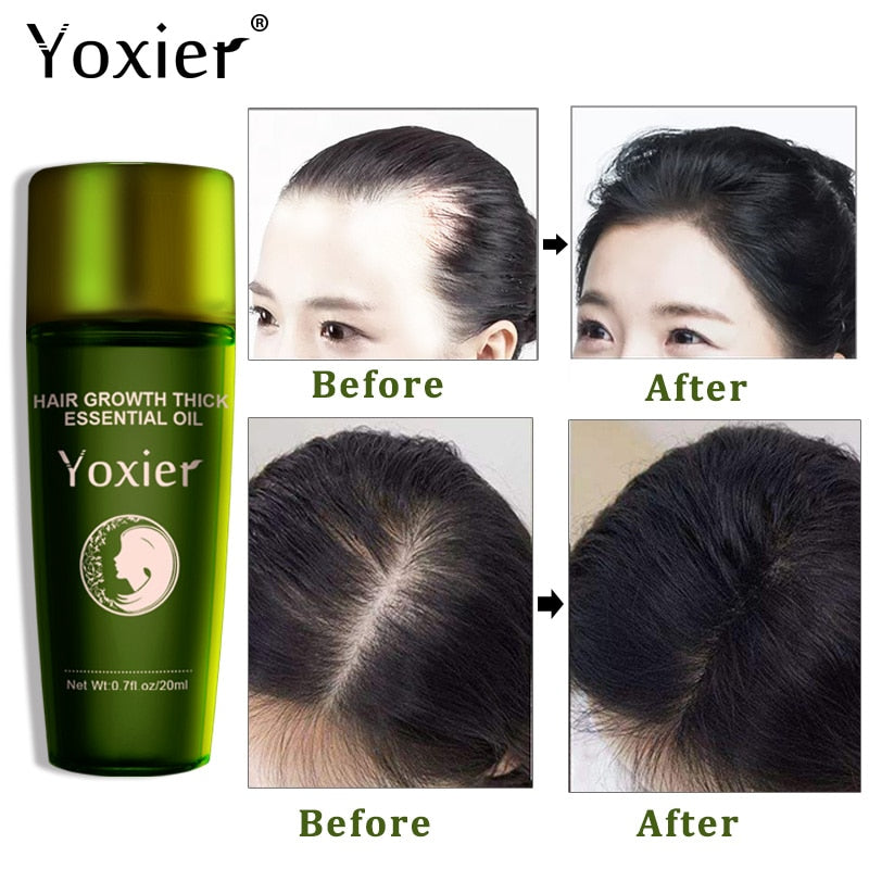 Herbal Hair Growth Oil