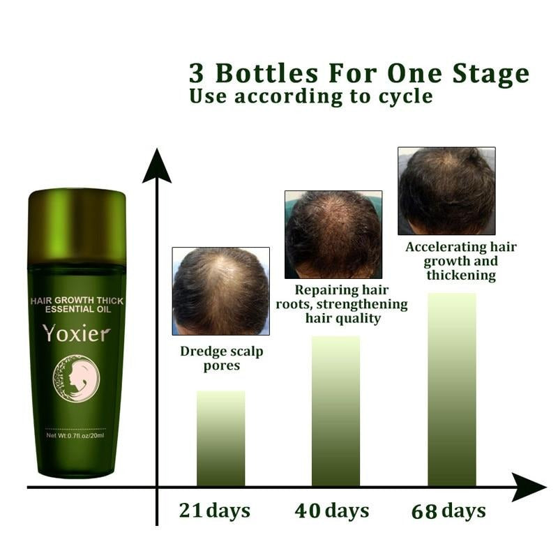 Herbal Hair Growth Oil