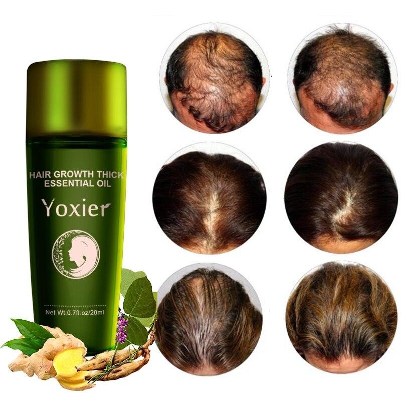 Herbal Hair Growth Oil four