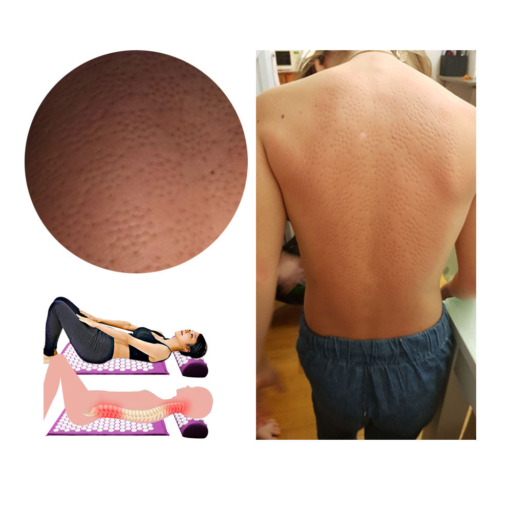 TOM Acupunture massage mat